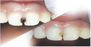 Baltimore kids dentist