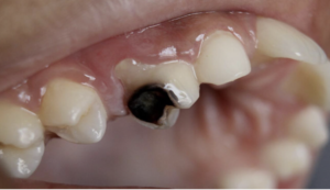 Baltimore kids dentist