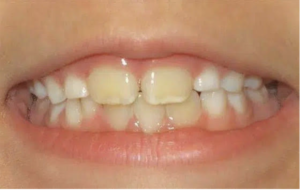 kids dentist near me