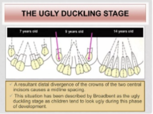 Howard County kids dental experts