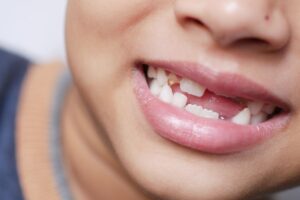 Howard County kids dental experts